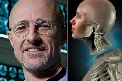 World’s first human head transplant