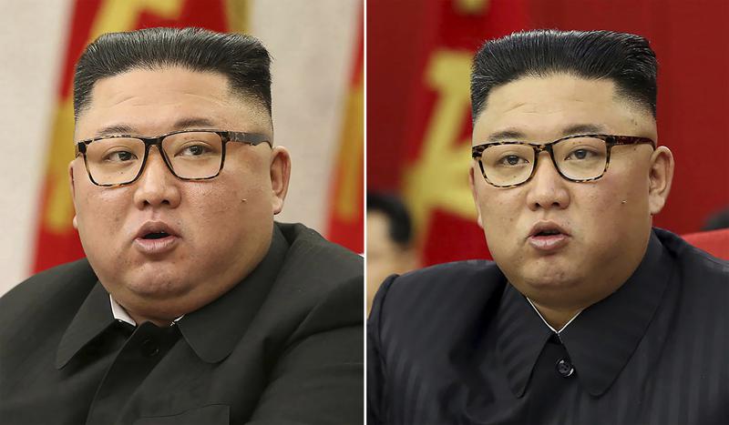 N Korea’s Kim looks much thinner, causing health speculation