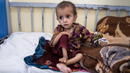 Inside the Kabul hospitals treating Afghanistan’s starving children