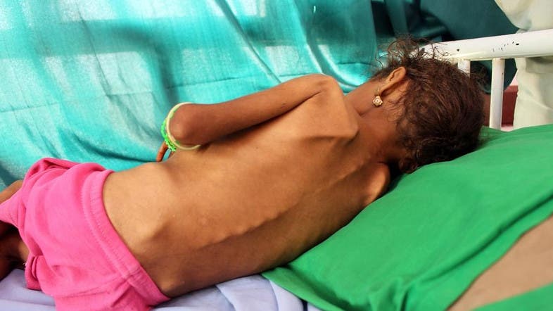 New ‘mercy flight’ from Houthi-held Yemen capital delayed